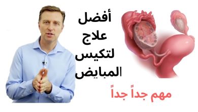 تعرفي علي طرق علاج تكيس المبايض بالأعشاب 5 990781628470126