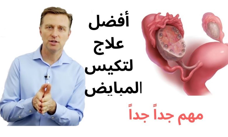 تعرفي علي طرق علاج تكيس المبايض بالأعشاب 1 990781628470126