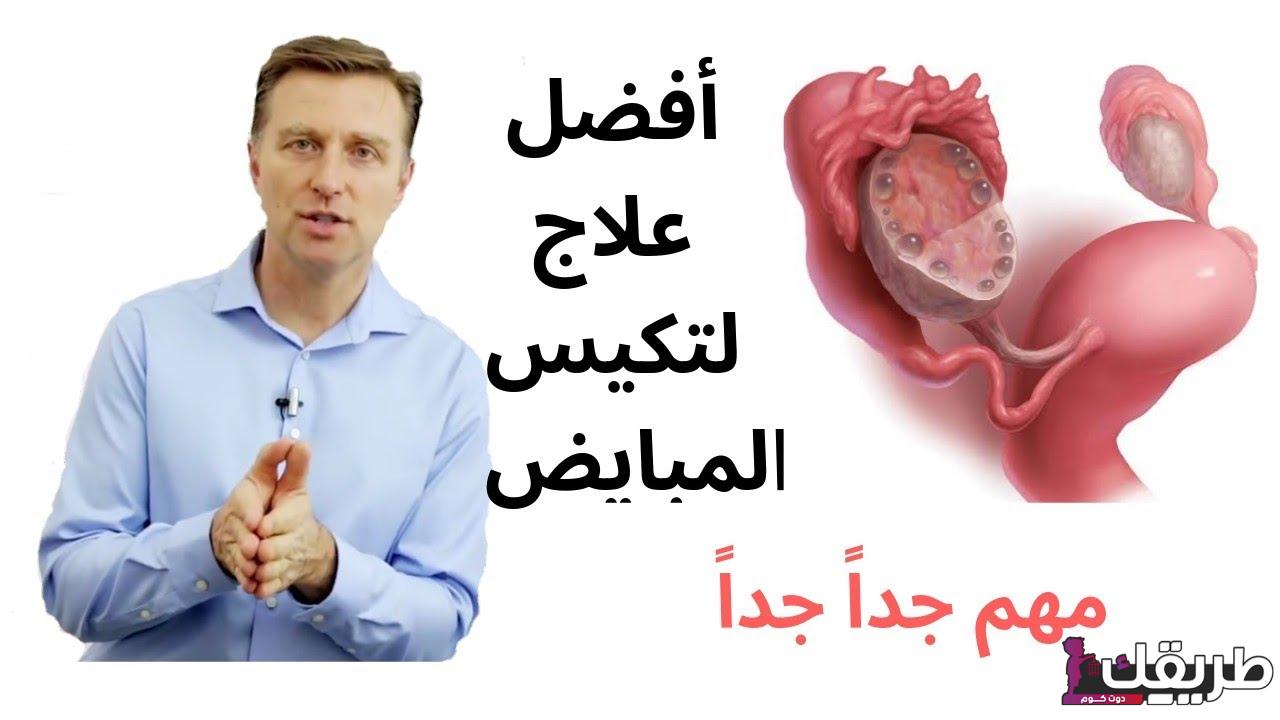 تعرفي علي طرق علاج تكيس المبايض بالأعشاب