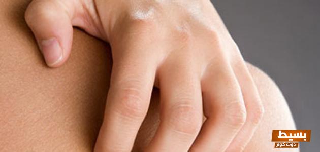 أسباب حكة الجسم عند النوم اكتشف العوامل المسببة وكيفية التغلب عليها! 1 11 36