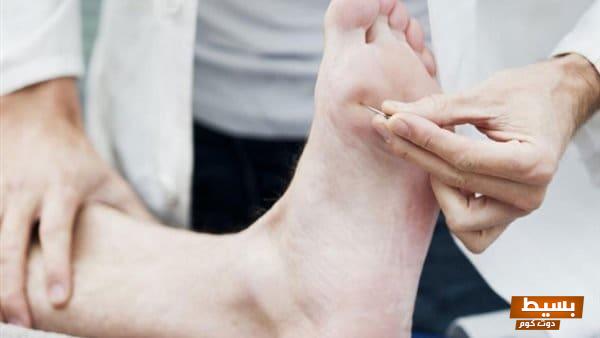 علاج التهاب الأعصاب الطرفية بالأدوية: اكتشف الحلول الفعالة التي تعيد لك حركة أطرافك وتخفف الألم بشكل سريع! 7 15