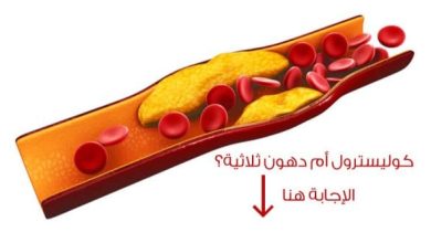 اكتشف الفرق الحاسم بين الكولسترول والدهون الثلاثية معلومات مهمة لصحتك! 2 22 3
