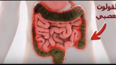 أفضل علاج فعال للقولون العصبي خطوات مذهلة ستغير حياتك! 4 47 2
