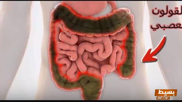 أفضل علاج فعال للقولون العصبي خطوات مذهلة ستغير حياتك! 1 47 2