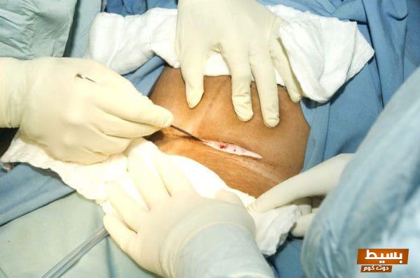 تفسير حلم الولادة القيصرية بدون ألم للمتزوجة: دلالات وأسرار قد تغير حياتك! 1 91 7