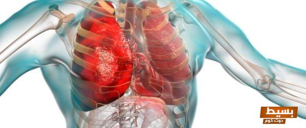 هل التهاب الرئة خطير اكتشف حقائق مثيرة قد تنقذ حياتك! 1 956