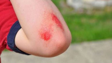 أدوية مذهلة تساعد على التئام الجروح بسرعة مدهشة! 7 أدوية تساعد على التئام الجروح6