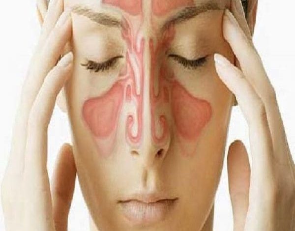 كيف تعرف أنك مصاب بالتهاب الجيوب الأنفية اكتشف العلامات التحذيرية وأهمية الرعاية الصحية الفورية! 1 أعراض التهاب الجيوب الأنفية