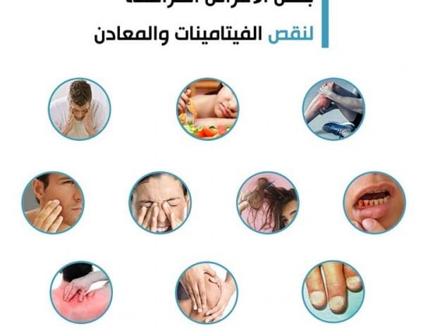 اكتشف الأعراض المدهشة لنقص الفيتامينات في جسمك وكيف تؤثر على صحتك العامة! 1 أعراض نقص الفيتامينات في الجسم