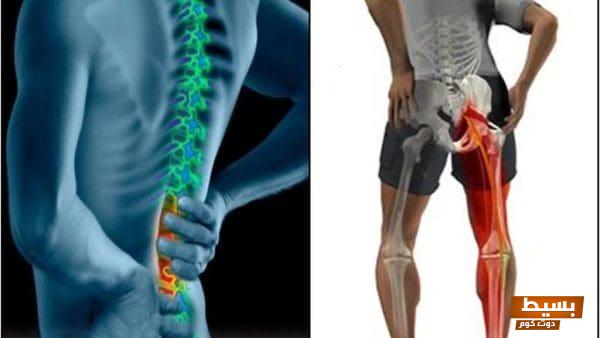 ألم أسفل الظهر يمين مع الورك أسباب، أعراض، وعلاج فعال للتخلص منه نهائيًا! 2 ألم أسفل الظهر يمين مع الورك