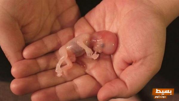 حلمت أني أجهضت وأنا لست حامل.. ما معنى هذا الحلم الغامض الذي يثير التساؤلات؟ 20 اجهضت وانا لست حامل