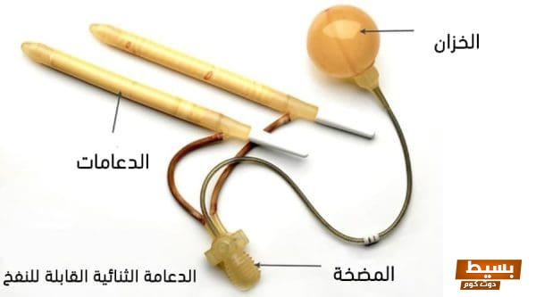 تجربتي الفريدة والمثيرة مع الدعامة الذكرية رحلة نحو استعادة الثقة والقدرة! 1 تجربتي مع الدعامة الذكرية