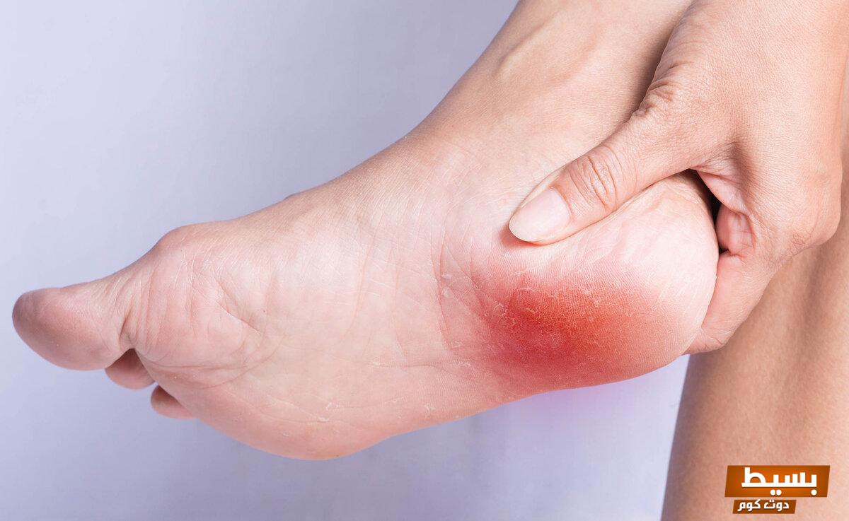 تجربتي الملهمة مع الشوكة العظمية كيف واجهت التحديات واستعدت لحياتي الطبيعية مجددًا 5 تجربتي مع الشوكة العظمية