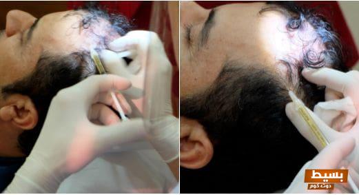 تجربتي الملهمة مع العلاج البيولوجي للصدفية: رحلة الشفاء والتغلب على التحديات 7 تجربتي مع العلاج البيولوجي للصدفية