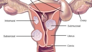 تجربتي الملهمة مع تليف الرحم رحلة الشفاء والتحديات التي واجهتها 4 تجربتي مع تليف الرحم