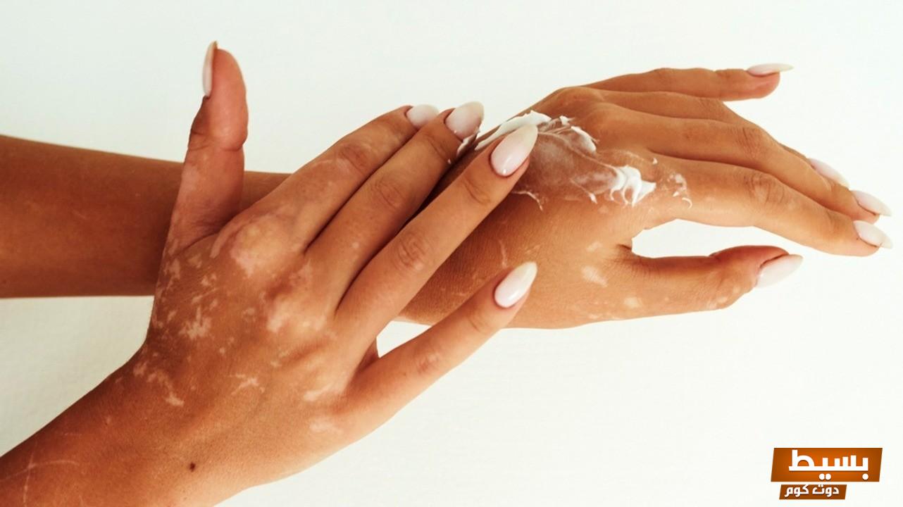 تجربتي الرائعة والمذهلة مع كريم فيتيليز اكتشفوا السر وراء النتائج المبهرة! 2 تجربتي مع كريم فيتيليز