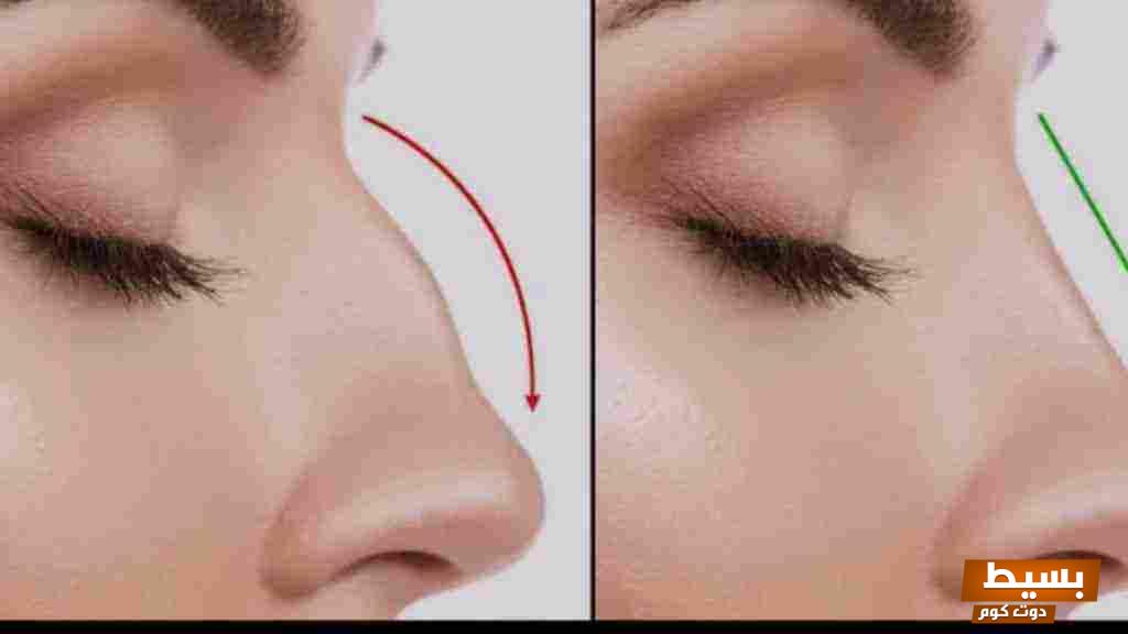 تصغير غضروف الأنف طبيعياً: اكتشف طرق فعّالة وآمنة لتحقيق مظهر جذاب وشكل مثالي! 2 تصغير الانف