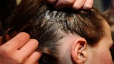 تفسير حلم قملة واحدة في الشعر: دلالات غامضة ومعاني عميقة تثير الفضول! 5 تفسير حلم القمل الاسود في الشعر للمتزوجه
