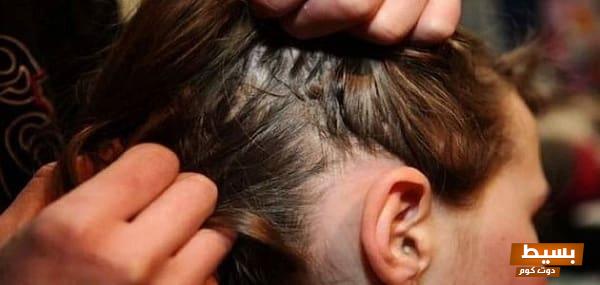 تفسير حلم قملة واحدة في الشعر: دلالات غامضة ومعاني عميقة تثير الفضول! 1 تفسير حلم القمل الاسود في الشعر للمتزوجه