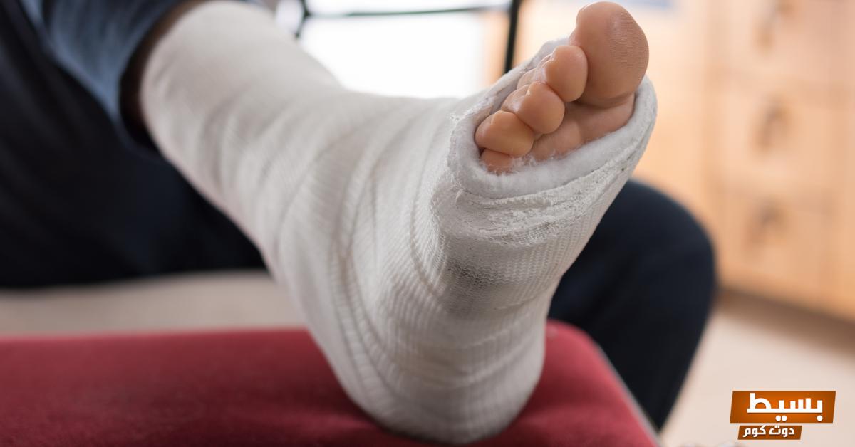 تعرف على تفسير حلم جبيرة القدم لشخص آخر ومعناه بالتفصيل اكتشف الرسائل الخفية والدلالات العميقة وراء هذا الحلم الغامض! 22 تفسير حلم جبيرة القدم لشخص آخر