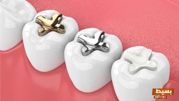 حشوة أسنان مذهلة تباع في الصيدلية: احصل على ابتسامة مذهلة في دقائق! 3 حشوة أسنان تباع في الصيدلية e1658058615203