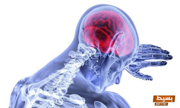 علاج نقص الدم في المخ اكتشف الحلول الفعالة لتجنب المخاطر واستعادة صحتك العقلية! 1 علاج نقص الدم في المخ