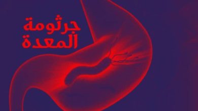 كم يستمر علاج جرثومة المعدة اكتشف الوقت الفعلي والتأثير على صحتك! 6 كم يستمر علاج جرثومة المعدة