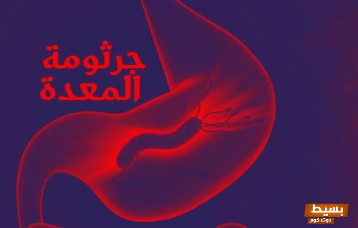 كم يستمر علاج جرثومة المعدة اكتشف الوقت الفعلي والتأثير على صحتك! 1 كم يستمر علاج جرثومة المعدة