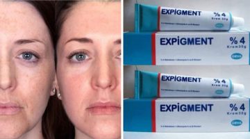 لماذا يستخدم expigment