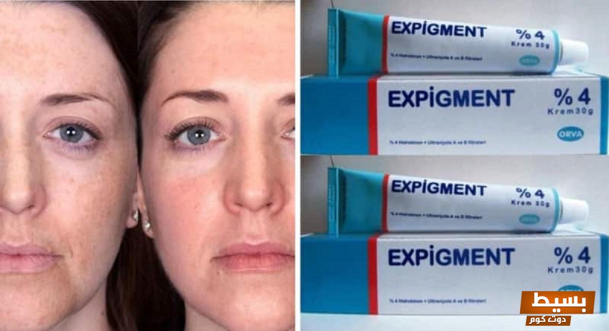 لماذا يستخدم expigment اكتشف السر وراء فعاليته في تفتيح البشرة وتحسين مظهرها! 7 لماذا يستخدم