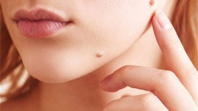 ما هو الثالول بالصور اكتشف الأسباب والعلاجات الفعالة لصحة جلدك! 2 ما هو الثالول بالصور2