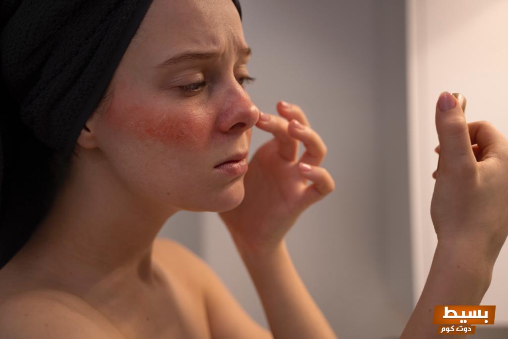 ماسكات لعلاج حروق الشمس اكتشف العلاجات الطبيعية الفعالة لبشرة صحية ومشرقة! 16 ماسكات لعلاج حروق الشمس